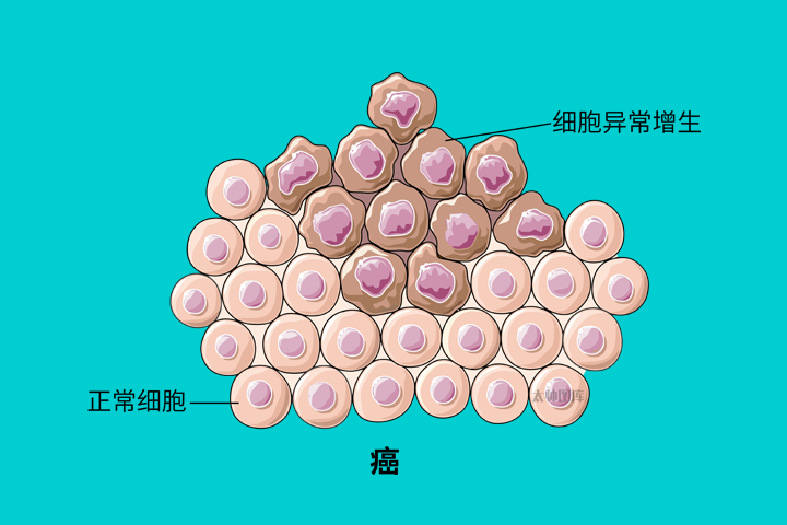 肿瘤形成机制