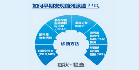 如何确诊前列腺癌？